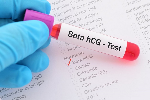 Xét nghiệm beta HCG MEDLATEC bao nhiêu tiền
